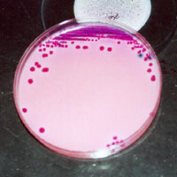 Coleta de Hemocultura – Curso da Albert Einstein