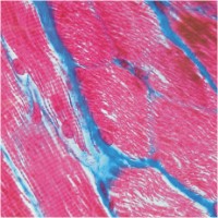 Curso de Tecido Epitelial