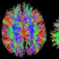 Curso de Neurociência aplicada à Educação Curso de Neurociência aplicada à Educação